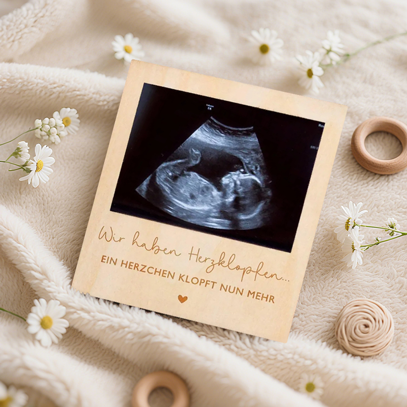 Echografie Zwangerschap Aankon - Engraved Wood Frame recensie en prijs